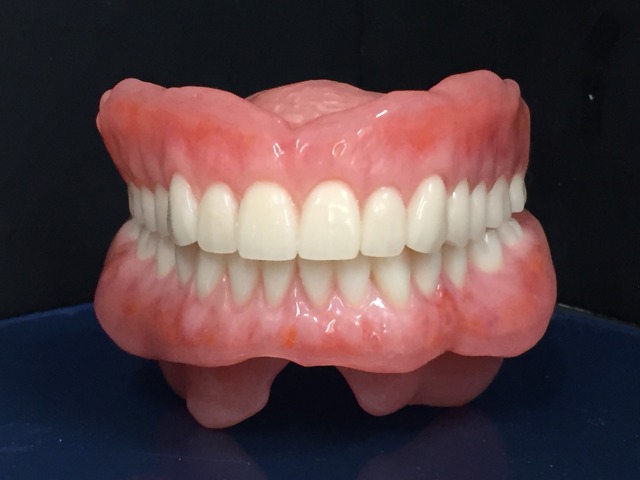 オーダーメイド義歯とは